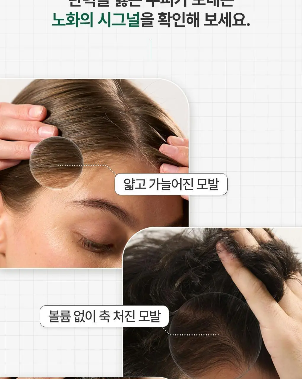 [두피활력 & 모발강화] 클로란 퀴닌 에델바이스 샴푸 더블 기획 (400ml 2입기획) 상세페이지 5